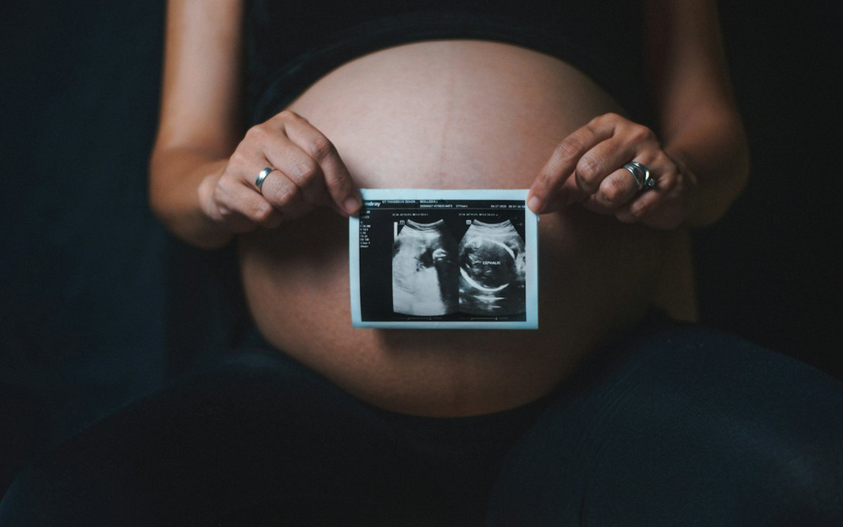 Gestante segurando uma imagem de ultrassom diante da barriga